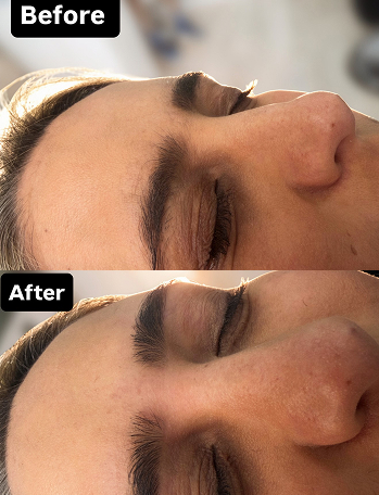 Eyebrow Threading